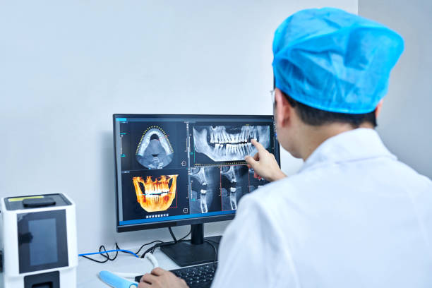 Best Emergency Root Canal Treatment in San Clemente, CA